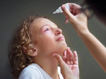 A child is using eye drops for pink eye.